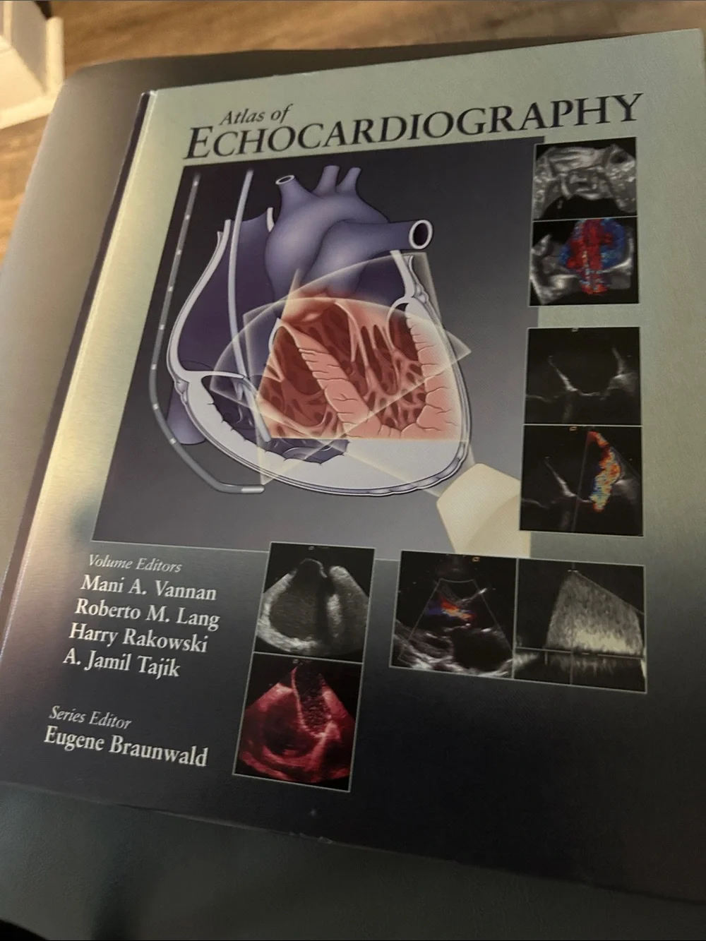 Atlas of Echocardiography - Blue Cover
